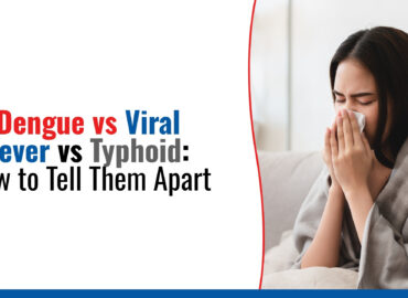 Dengue vs Viral Fever Dengue vs Viral Fever