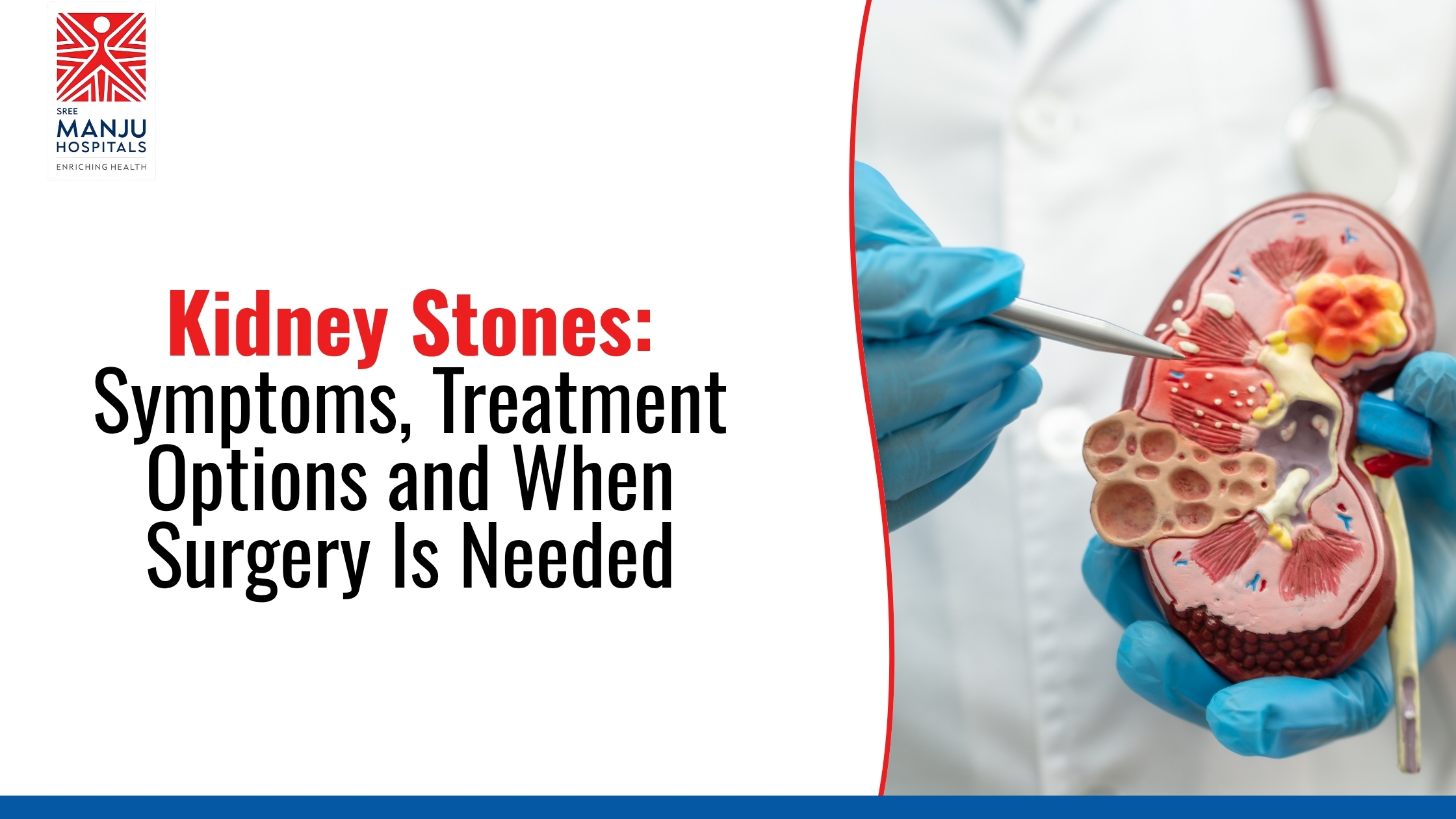 Kidney stone symptoms