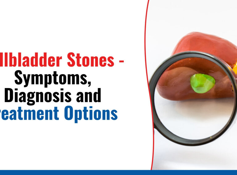 Gallbladder Stones - Symptoms, Diagnosis and Treatment Options Gallbladder Stones - Symptoms, Diagnosis and Treatment Options